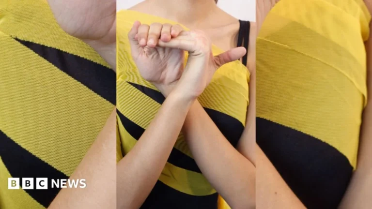 A BBC health explainer about the symptoms of Hypermobility Spectrum Disorder